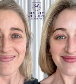 Beverly Wilshire Aesthetics Beverly Hills Medical Spa