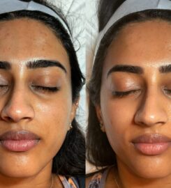 Beverly Wilshire Aesthetics Beverly Hills Medical Spa