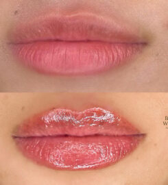 Beverly Wilshire Aesthetics Beverly Hills Medical Spa
