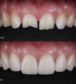 ID Dental and Implant Center