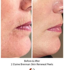 Dyad Skin and Wellness