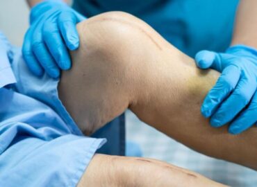 Dr Vikas Jain | Joint and Knee Replacement Surgeon in Indore