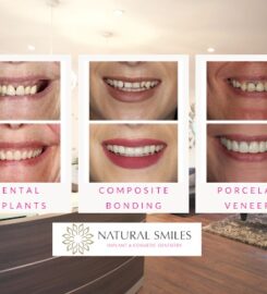 Natural Smiles Corby