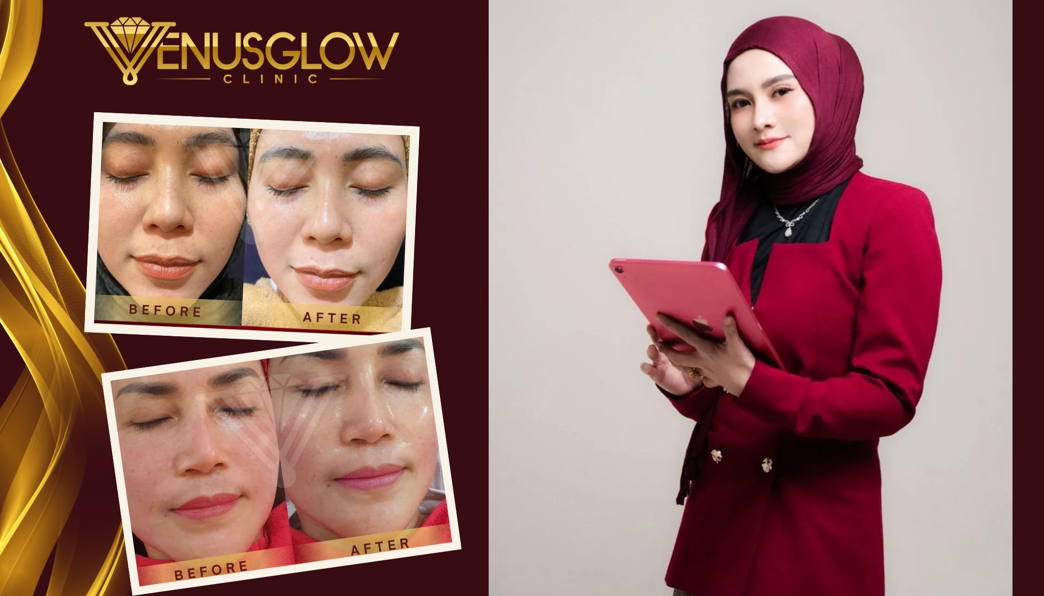 Venus Glow Clinic