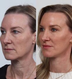 Locketz Facial Plastic Surgery
