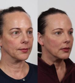Locketz Facial Plastic Surgery