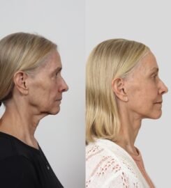Locketz Facial Plastic Surgery