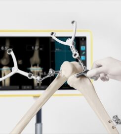 Dr. Divyanshu Goyal | Orthopedic surgeon in Indore