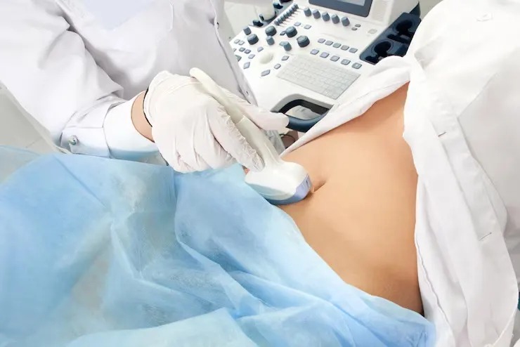 Dr. Shazi Qureshi – Best Gynecologist in Indore