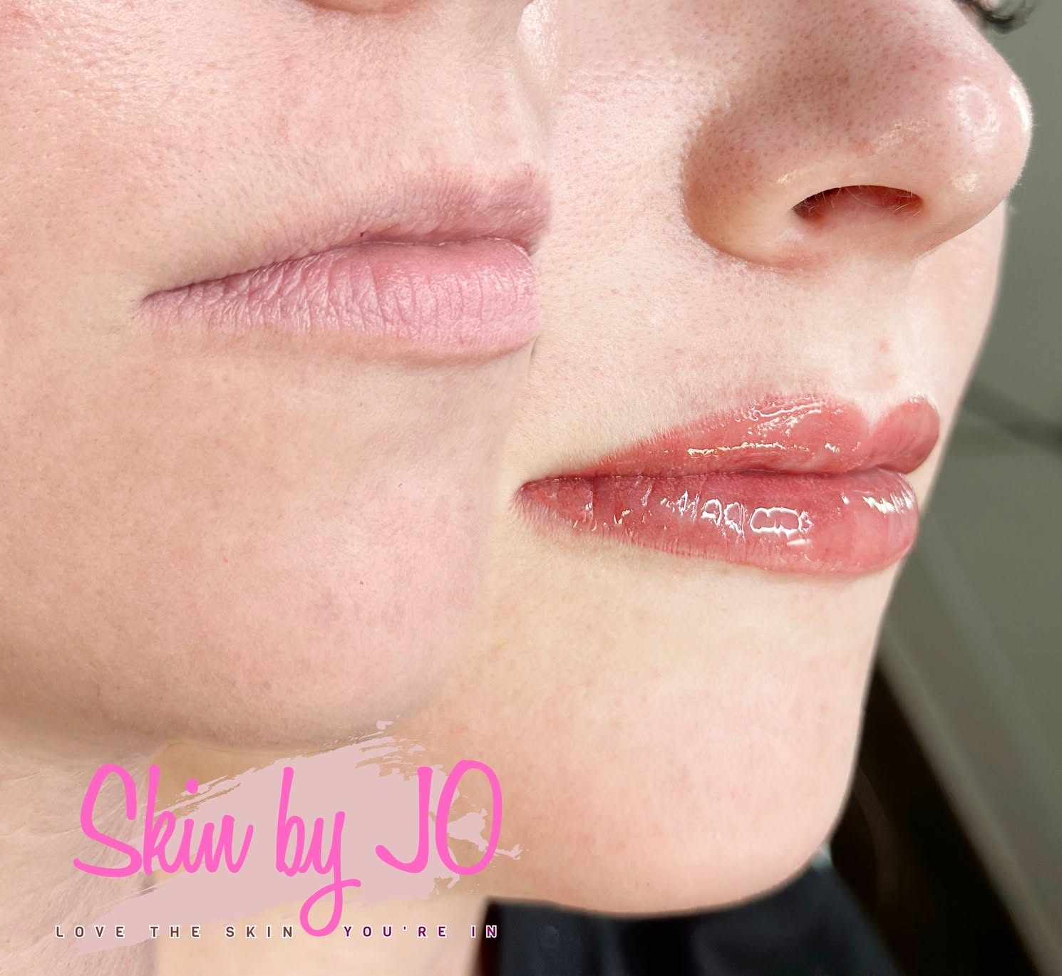Skin By Jo