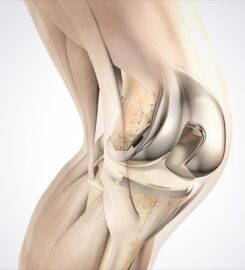Dr. Divyanshu Goyal | Orthopedic surgeon in Indore