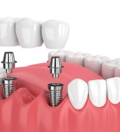 mh2 dental – St. Lawrence Market