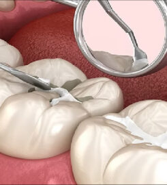 mh2 dental – St. Lawrence Market
