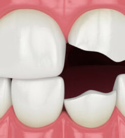 mh2 dental – St. Lawrence Market