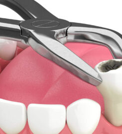 mh2 dental – St. Lawrence Market