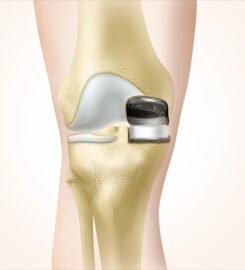 Dr. Divyanshu Goyal | Orthopedic surgeon in Indore