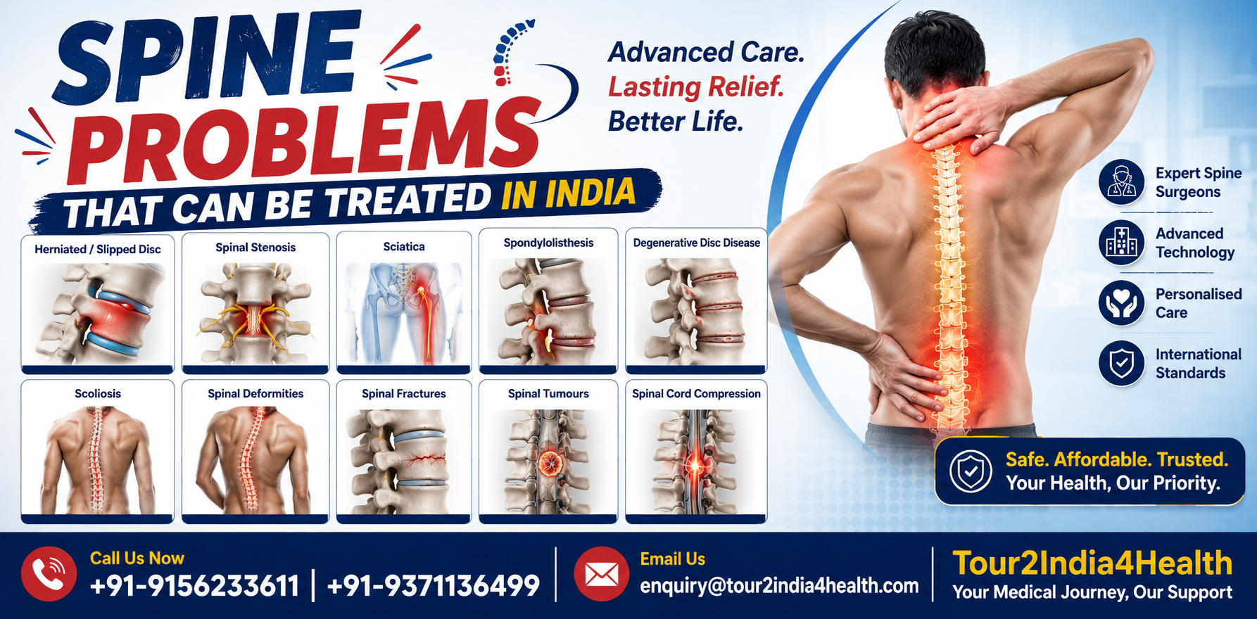 Looking for the Best Spine Surgeons in India for Australian Patie &hellip;