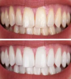 Vegas Dental Experts