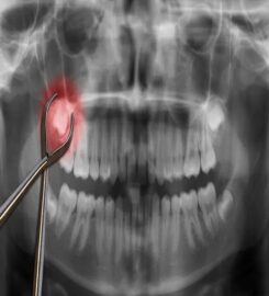 Vegas Dental Experts