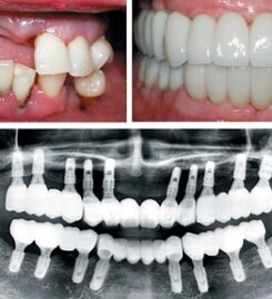 Align Dental Care