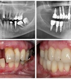 Align Dental Care