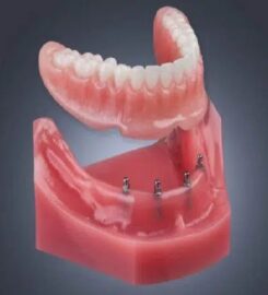 Vegas Dental Experts