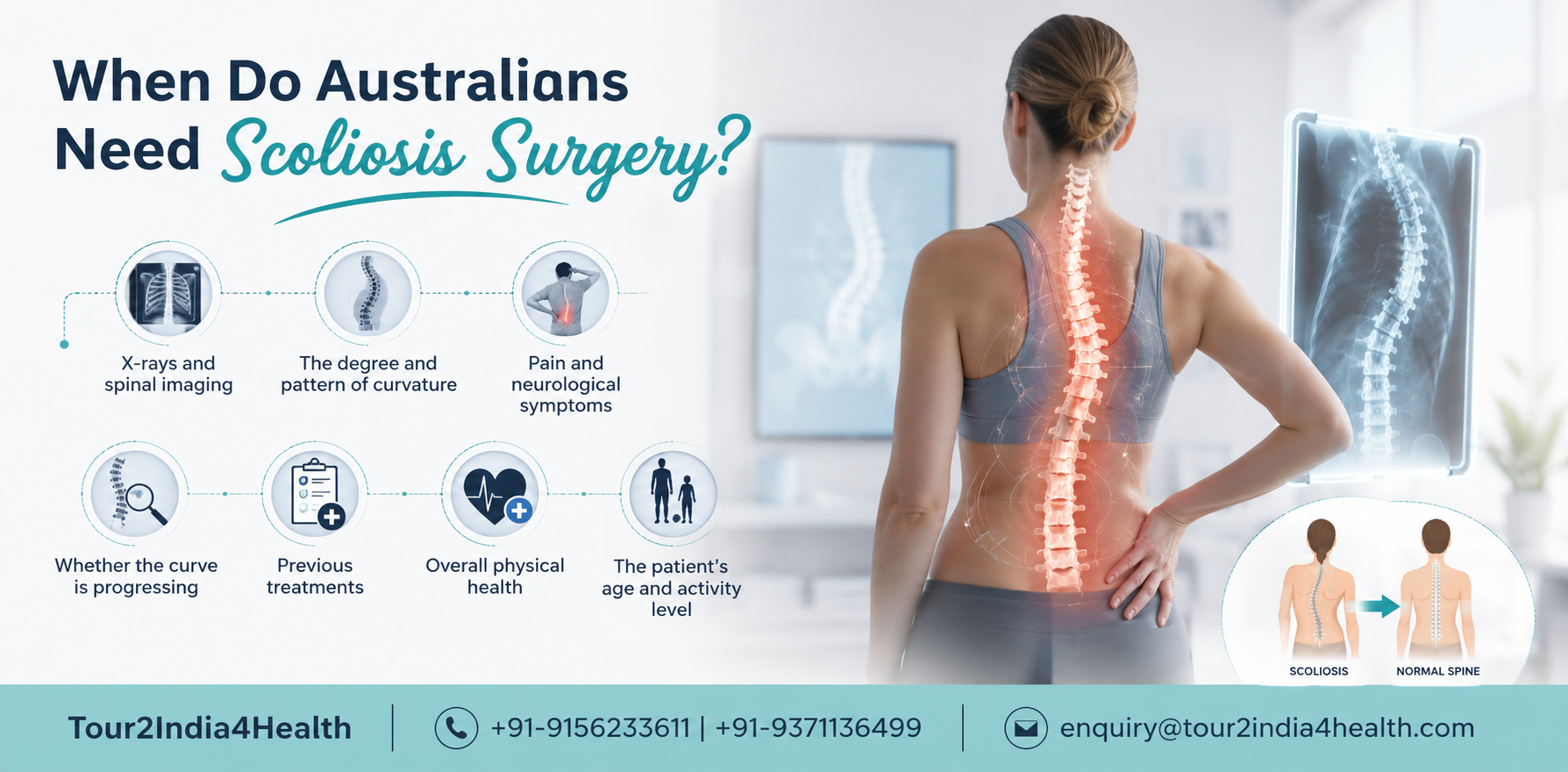 Scoliosis Correction Surgery in India for Australians