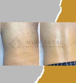 Mink Total Medical Spa & Wellness