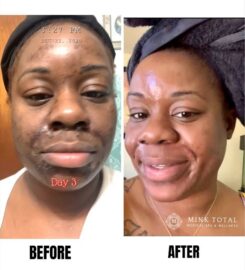 Mink Total Medical Spa & Wellness